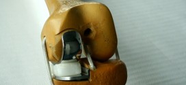 protesi-articolazioni