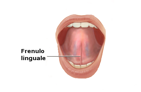 frenulo_linguale_anchiloglossia